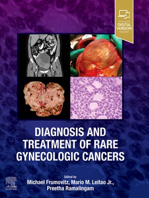 cover image of Diagnosis and Treatment of Rare Gynecologic Cancers--E-Book
